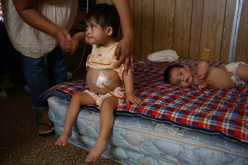 Rosa's child has Down's Syndrome and other ailments which require her to receive food through a tube in her stomach.  She desperately needs to see a pediatrician. 1img_2399