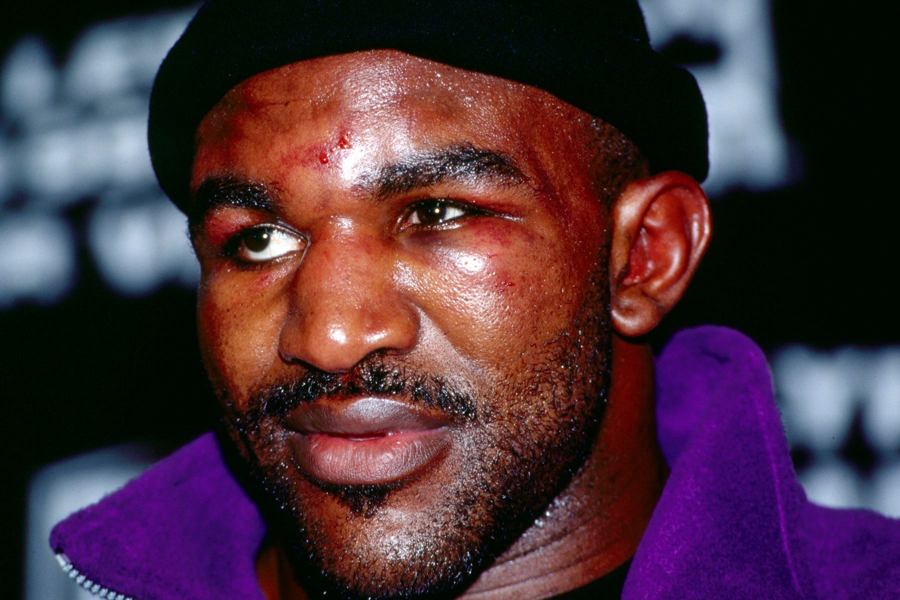 Evander "REAL DEAL" HOLYFIELDpictured after taking beating from John Ruiz.
