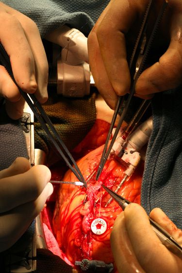 Photographed for Fresno Heart Hospital