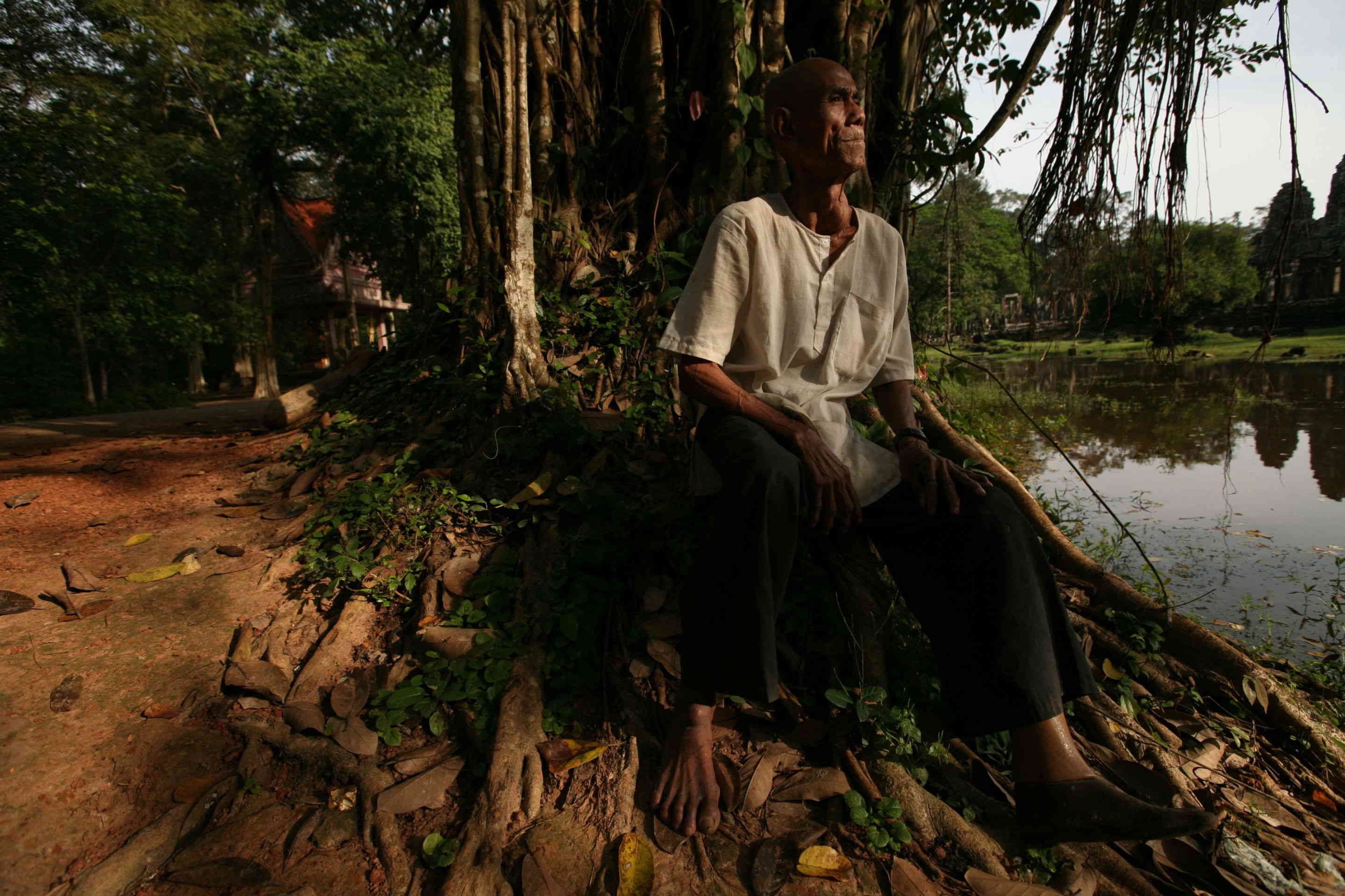 1img_3915_copy_landmine_victim_siem_reap_cambodiajpg