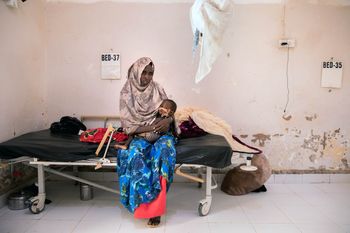 Children with malnutrition in Somalia