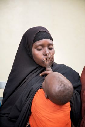 Famine in Somalia