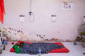 A young child with malnutritio