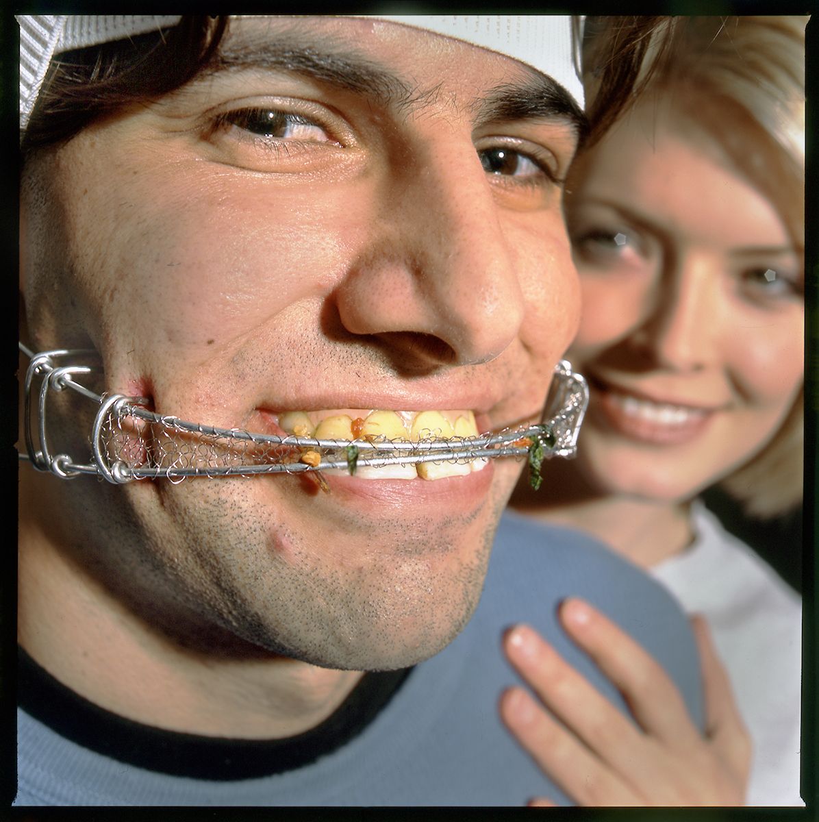 "HOW TO EAT SUCCESFULLY WHILE WEARINGBRACES"