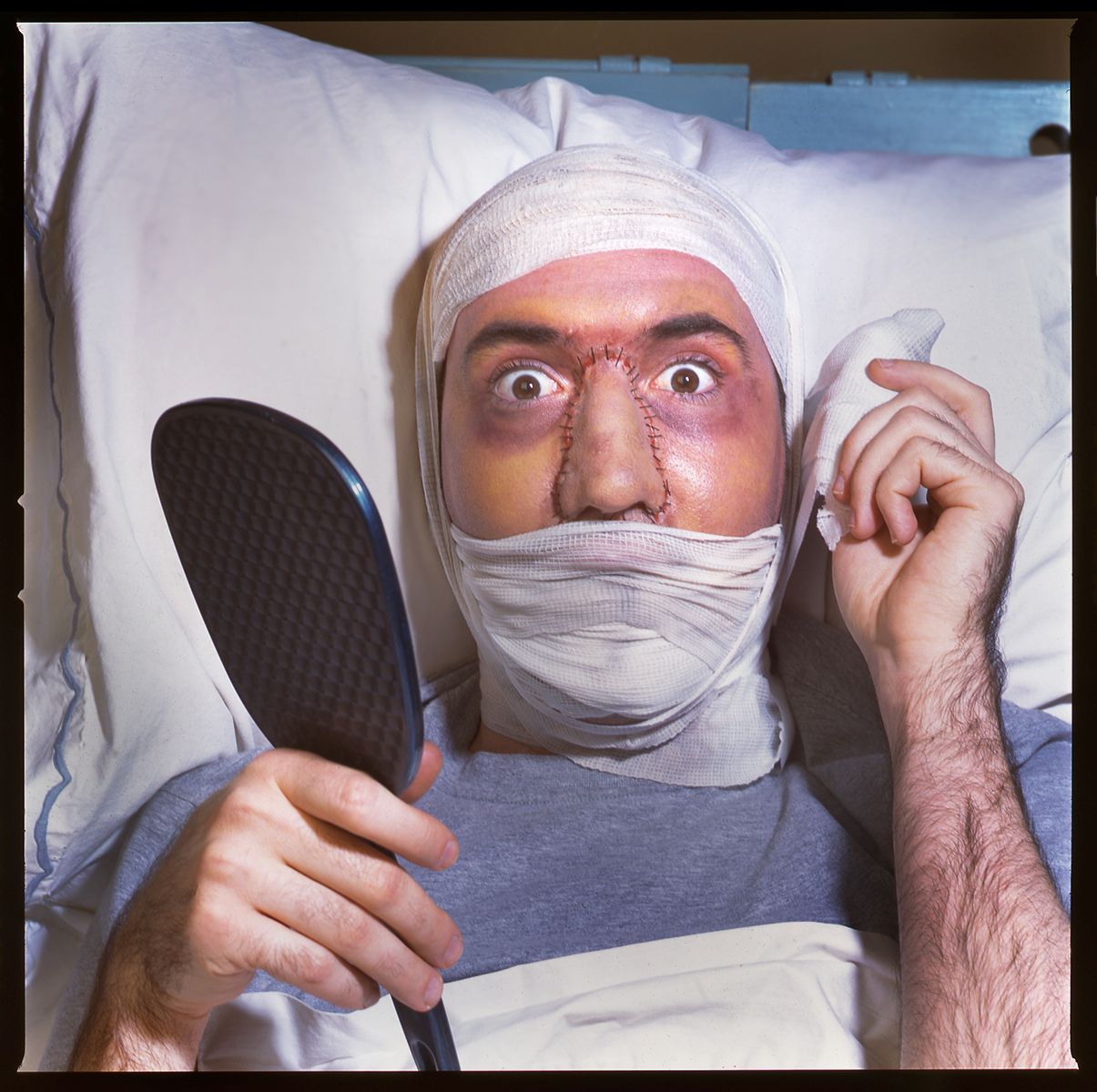 "ADVICE FOR AFTER AN UNWANTED SURGERY"