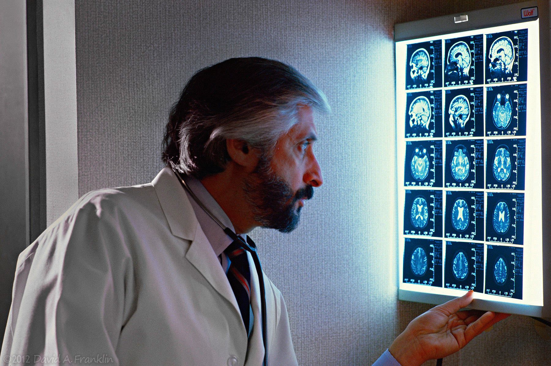 Neurologist_DrSaper_ExaminesMRIBrainScans_Newsweek_Editorial