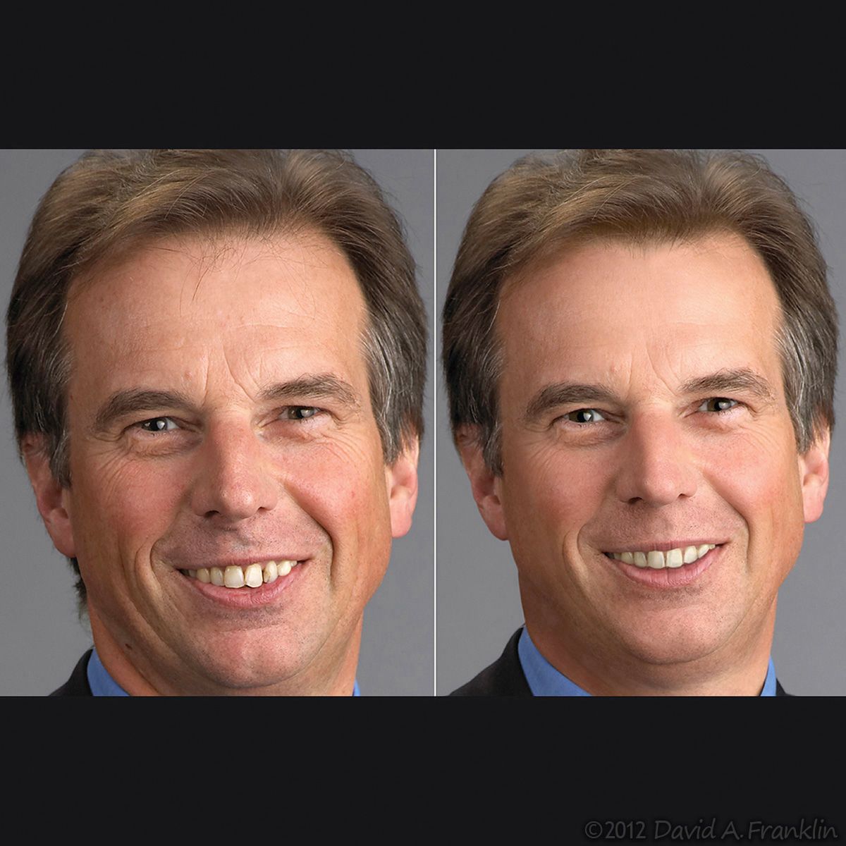 Retouching_ExecutivePortrait_BothMajor&SubtleChanges_Before&After