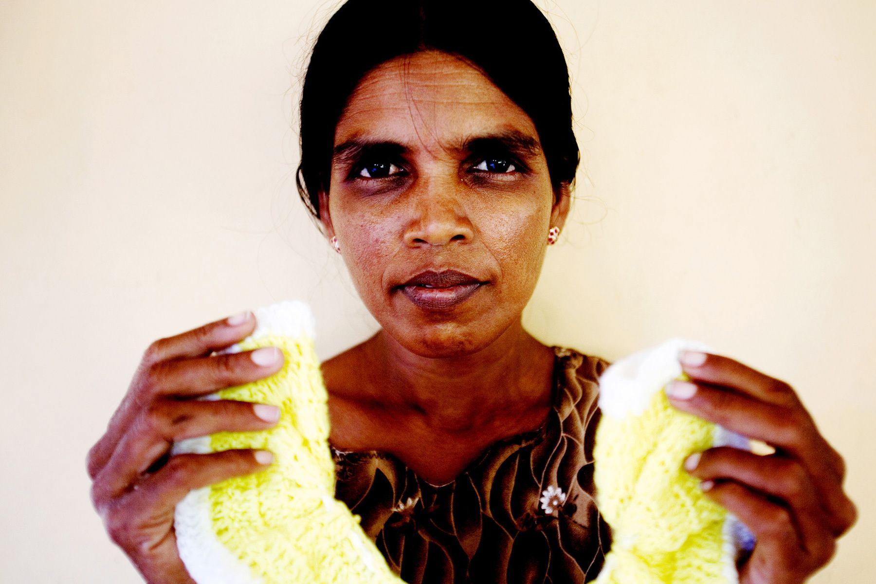 She became twenty-seven this year and has lived at the mental health care center for thirteen years.She is learning to crochet and sells the goods to a shop to earn a little money. 
