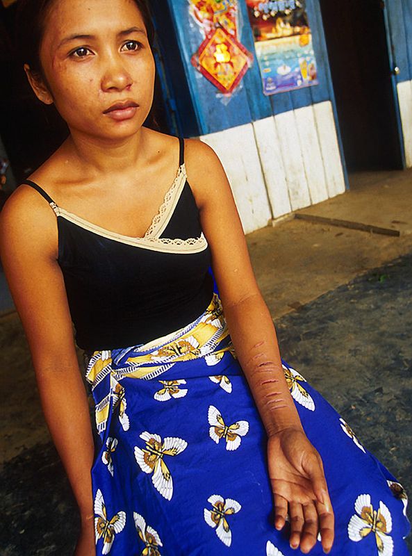 Who Cares HIV AIDS in Cambodia Masaru Goto Photography 