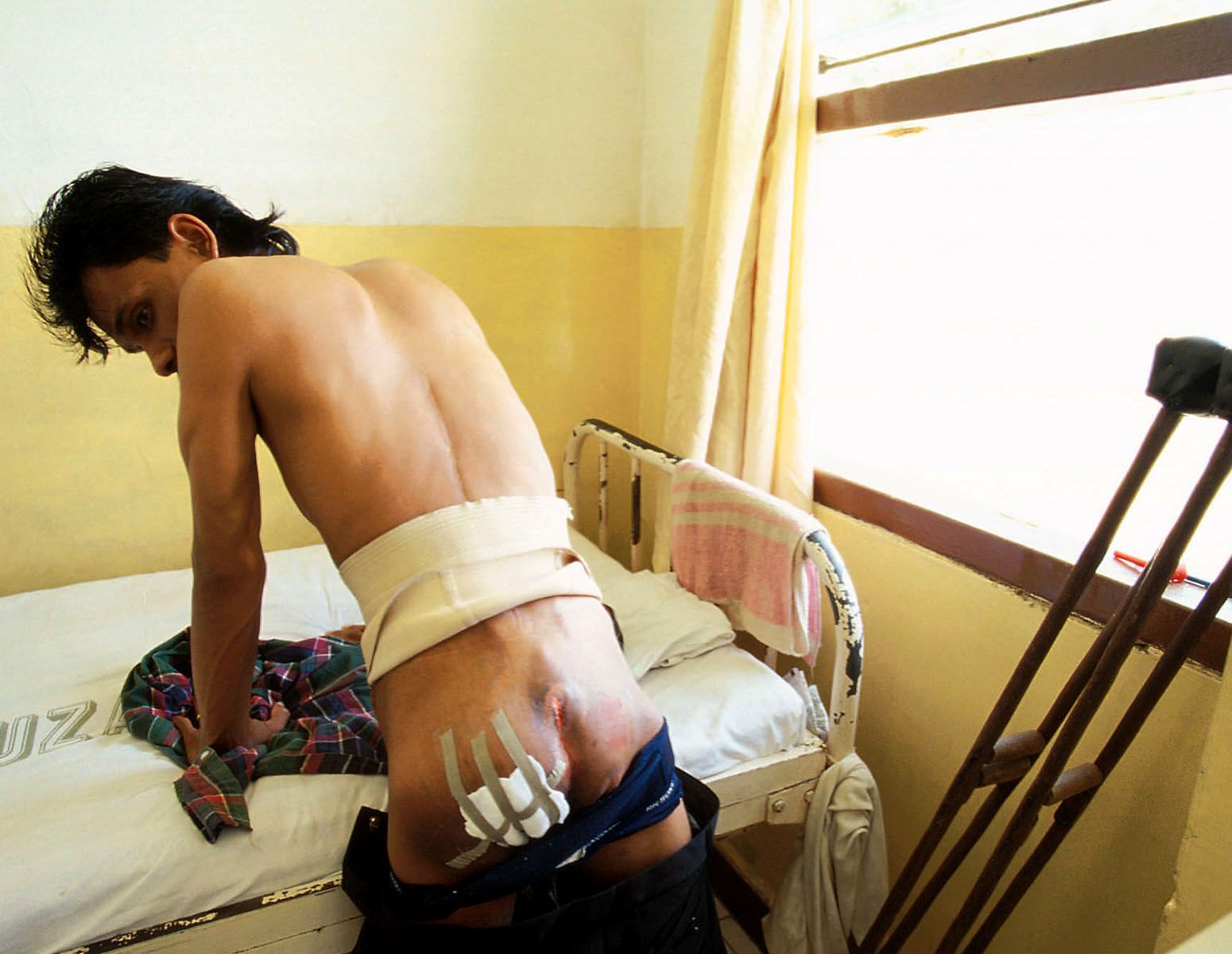 A tortured victim.Zainal Abidin hospital. 