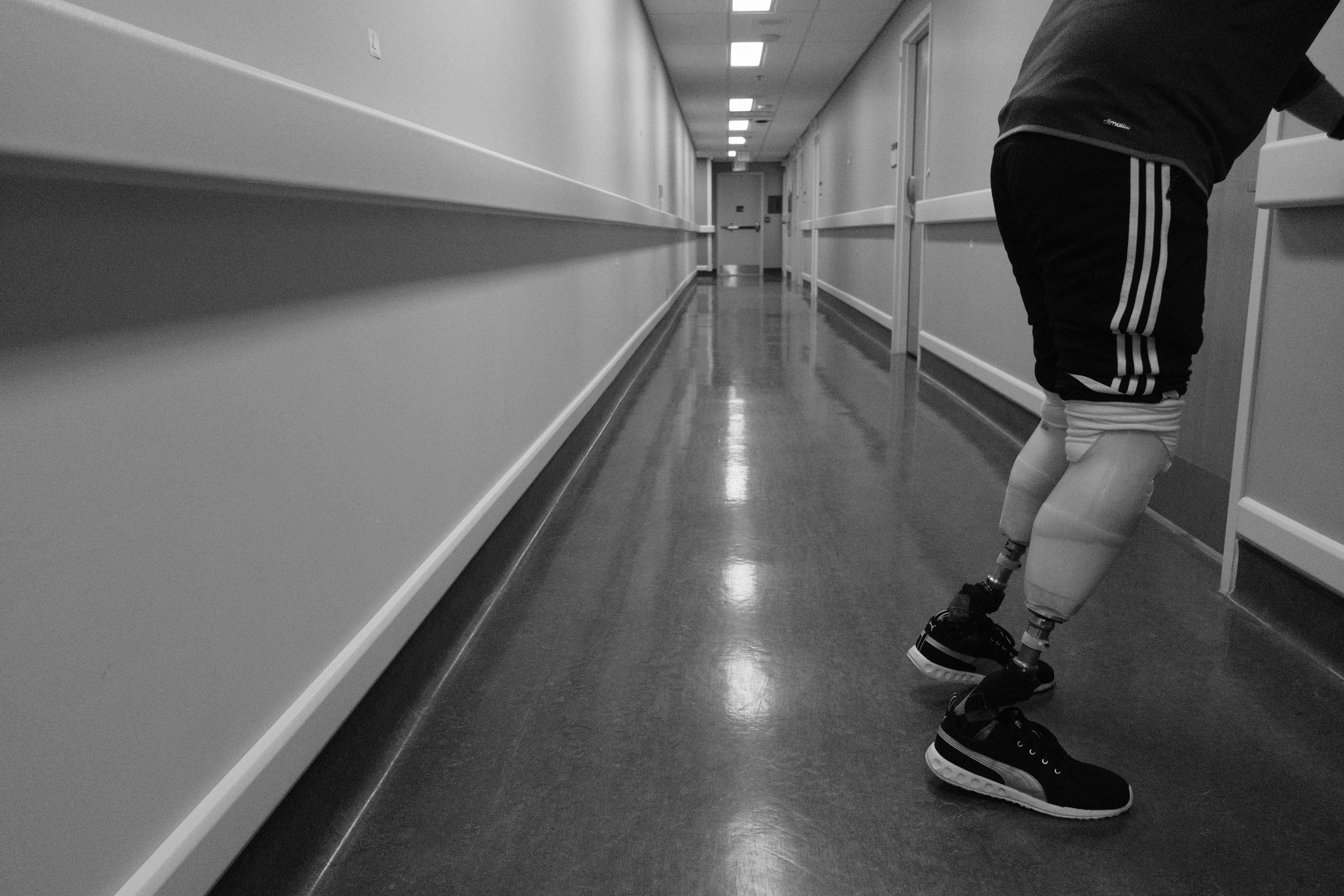 Sunnybrook-A new prostheic 