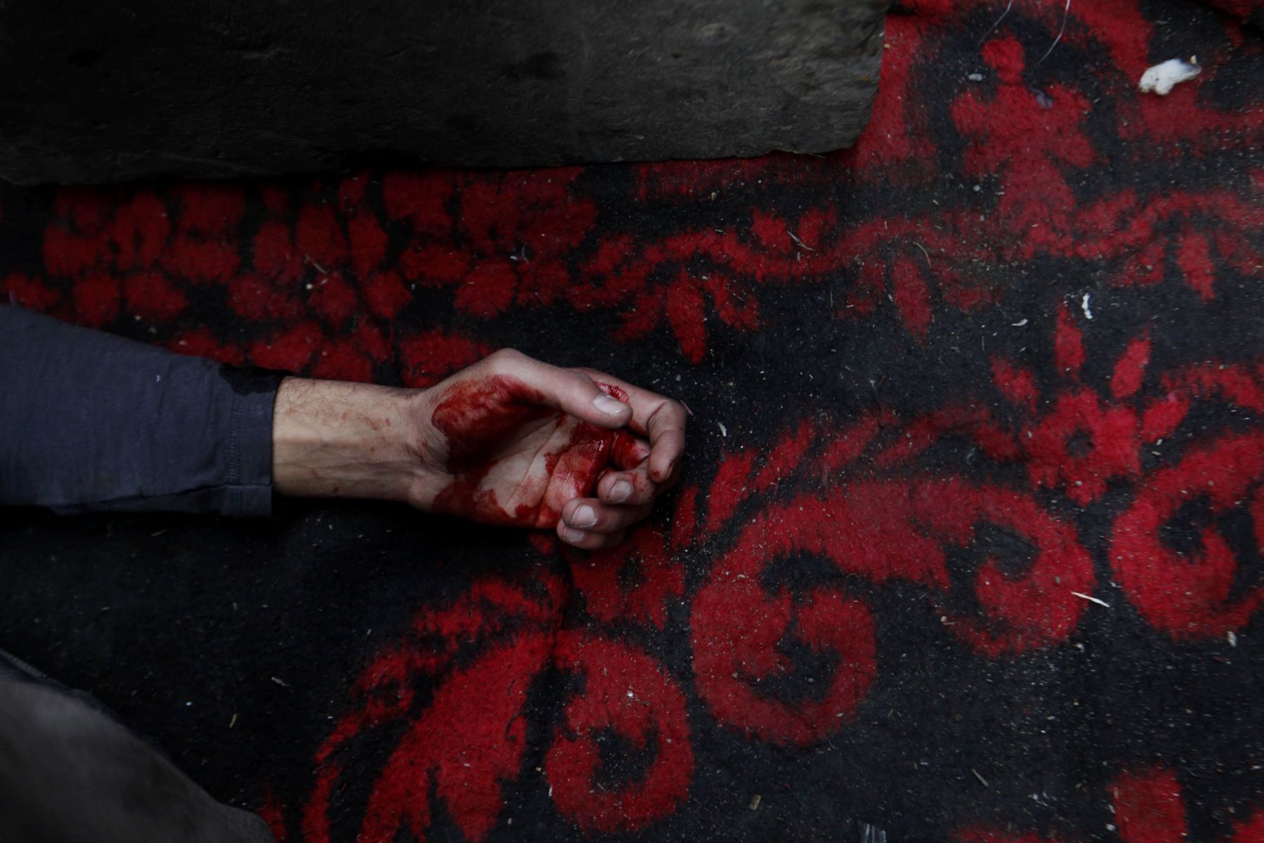 Wounded anti Mubarak Protestor in Cairo, Egypt. 