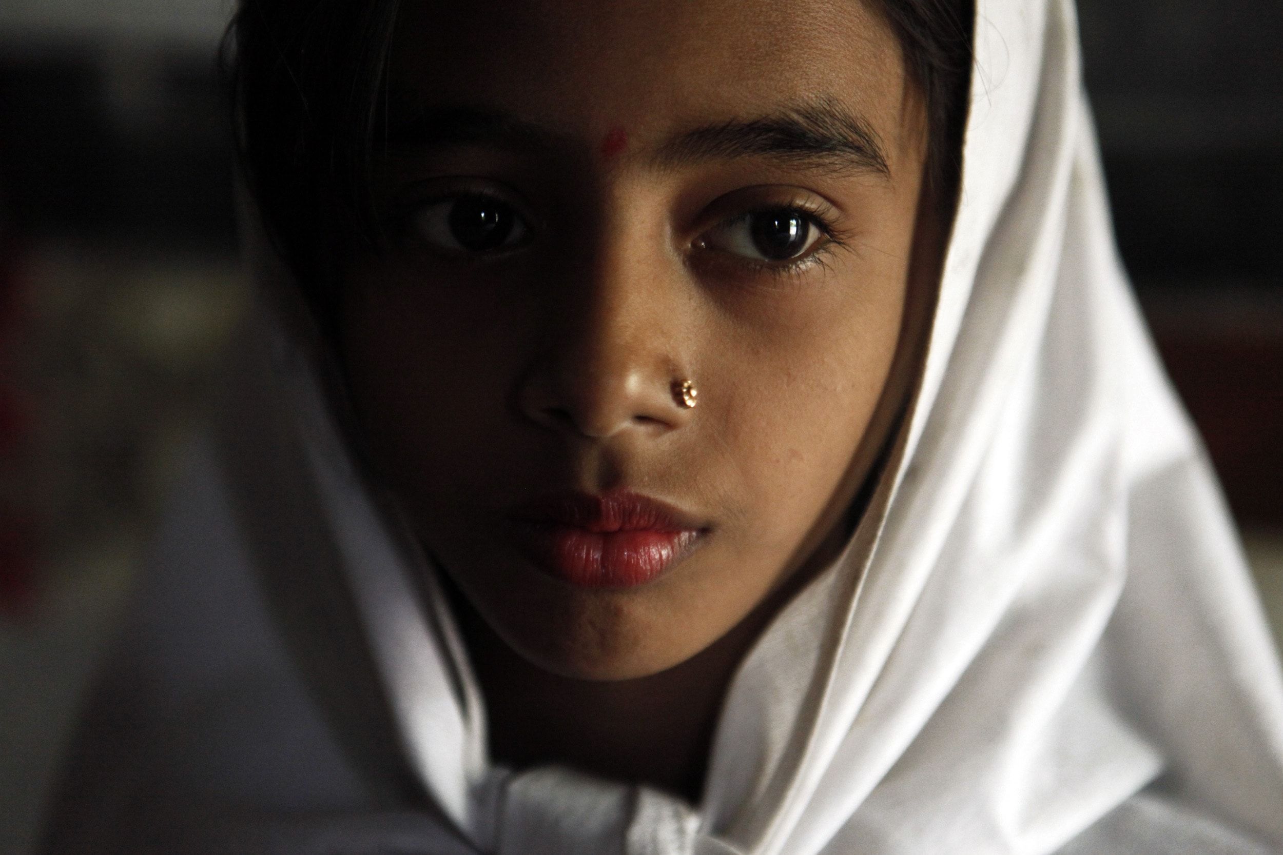 A malnourished Bangladeshi girl poses for a portrait.