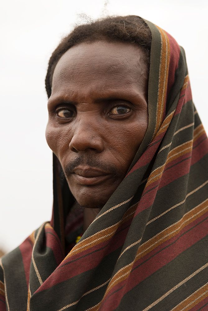 Ethiopia