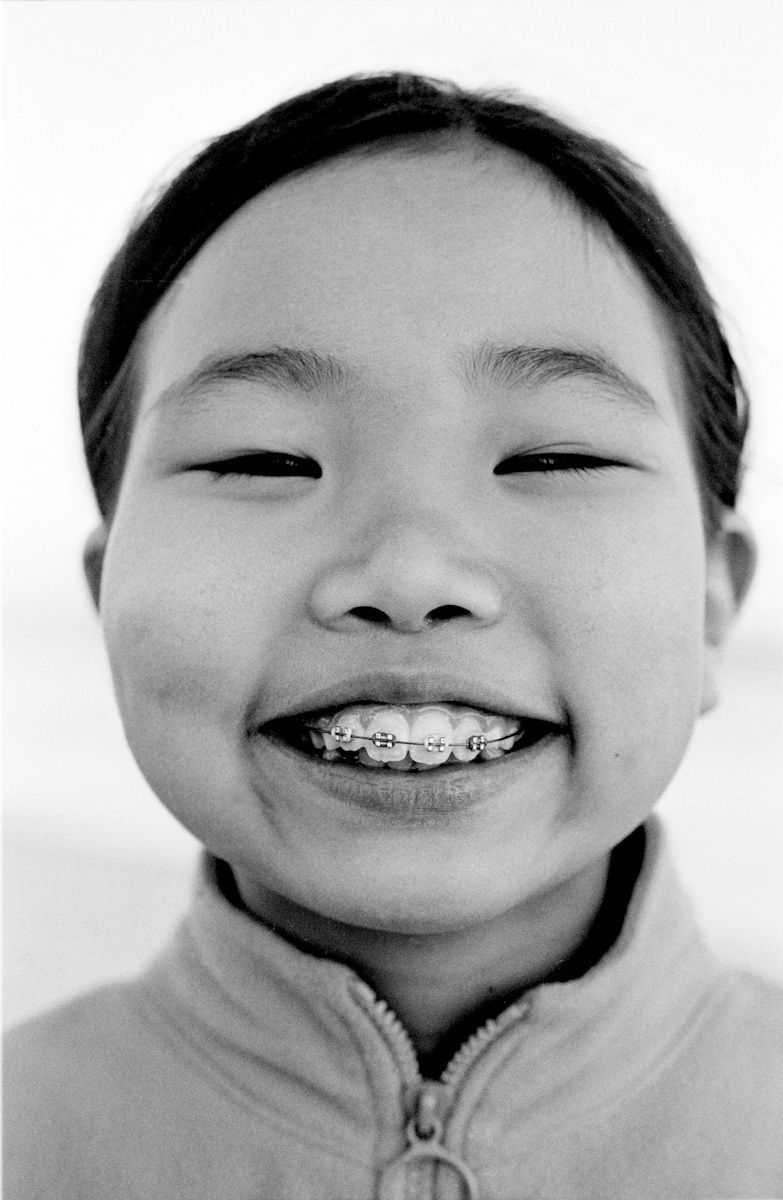 braces photo braces photo