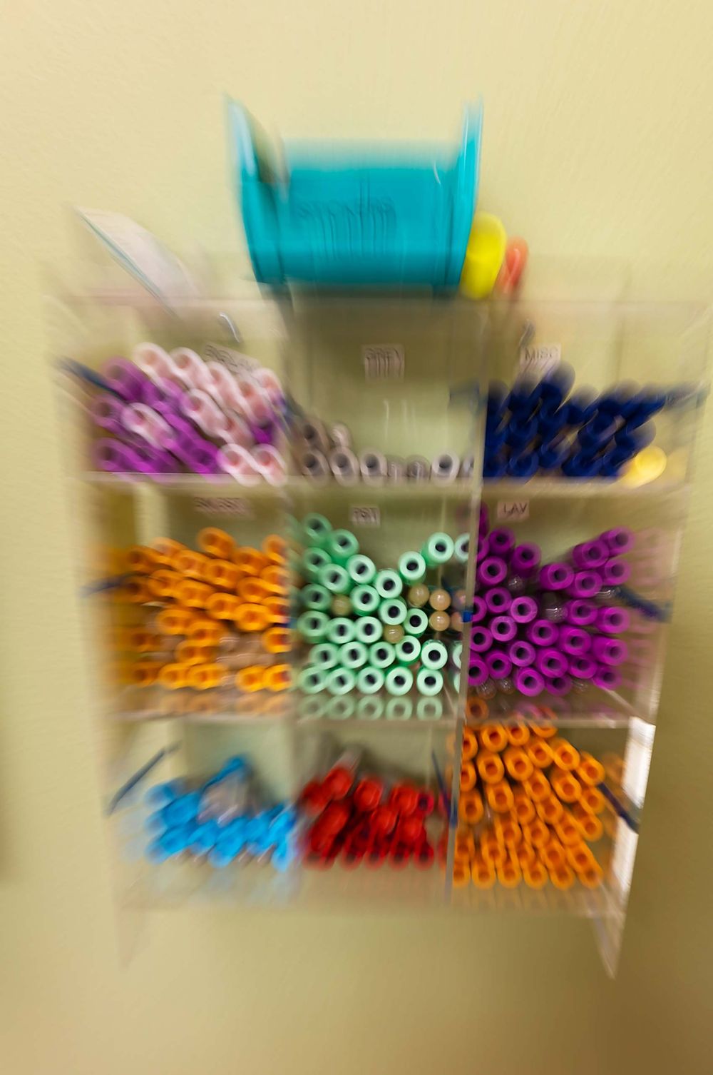 Blood test tubes vials in Davis Califorina