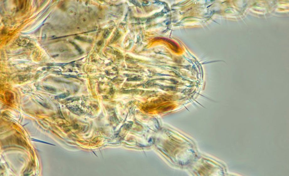 Human Body Louse