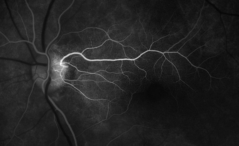 Bus card cilioret artery.jpg