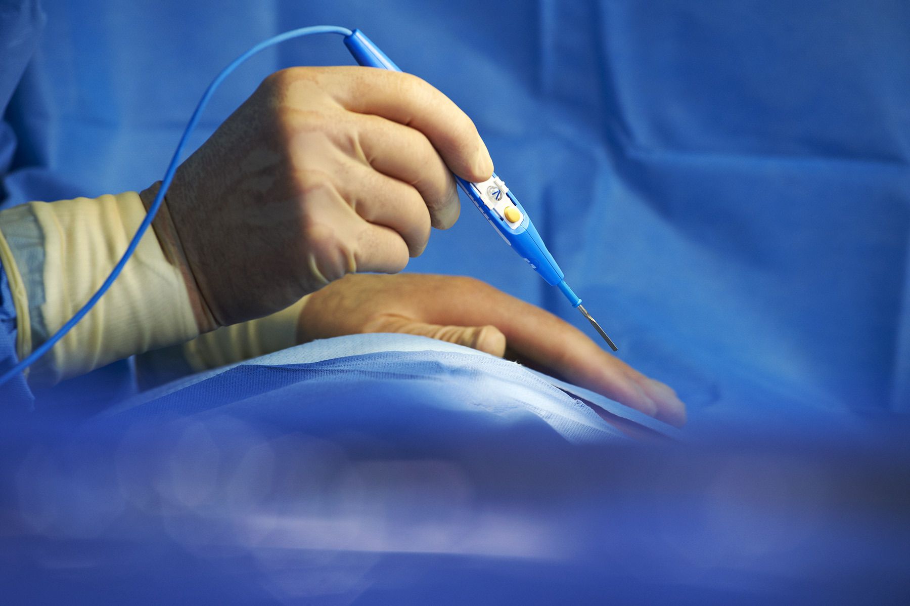 Medical device product shot.