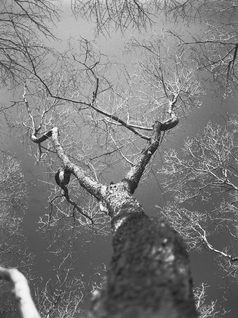 The Moment Before I Broke My Arm in Half