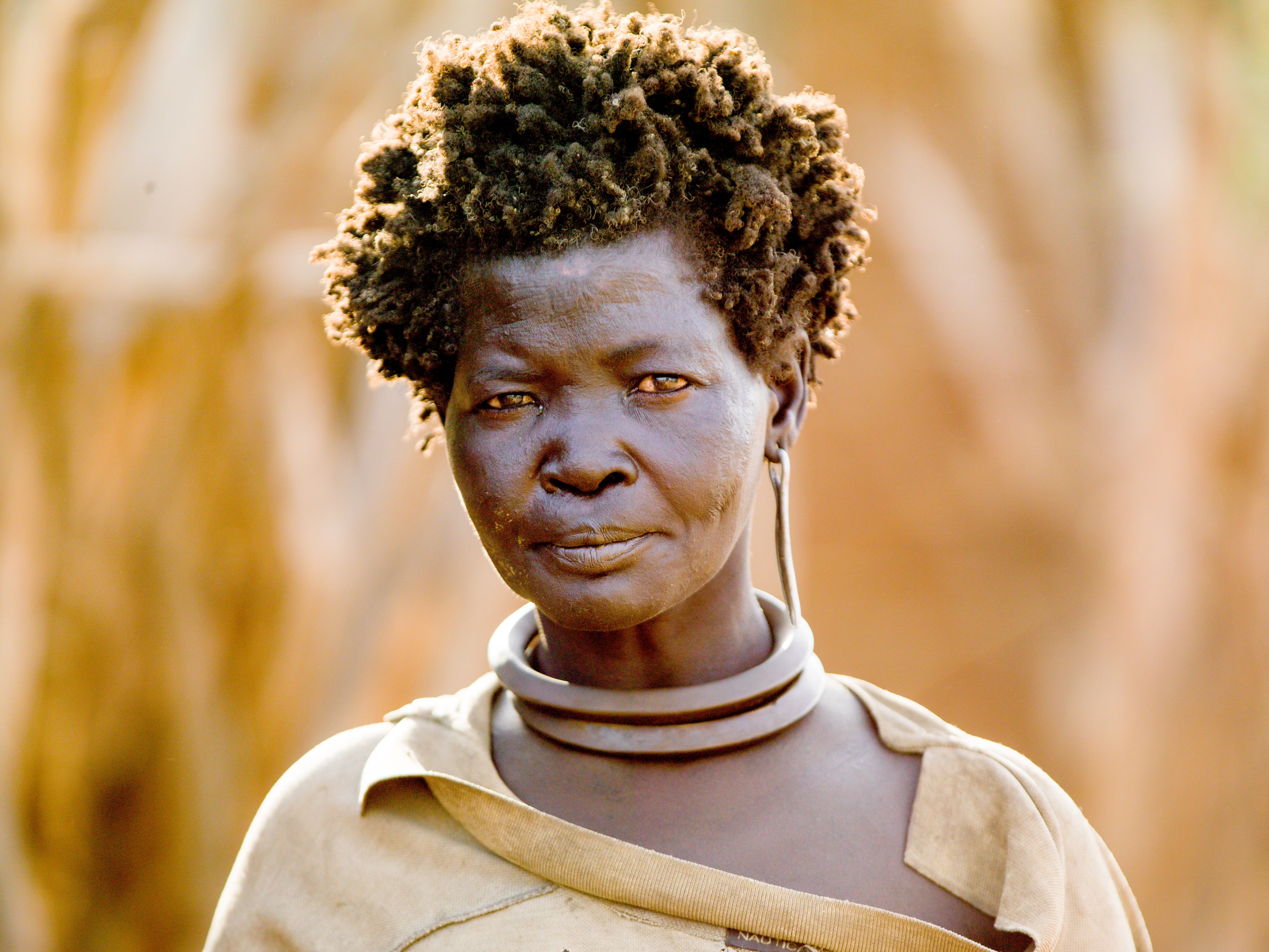 Leprosy in Ethiopia