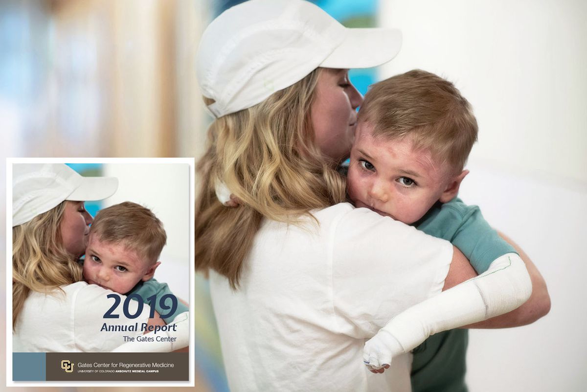 Annual report cover photography for 2019 Gates Center for Regenerative Medicine depicting child with EB skin disease looking at camera while being held by mother. Cover Gates center For Regenerative Medicine.jpg