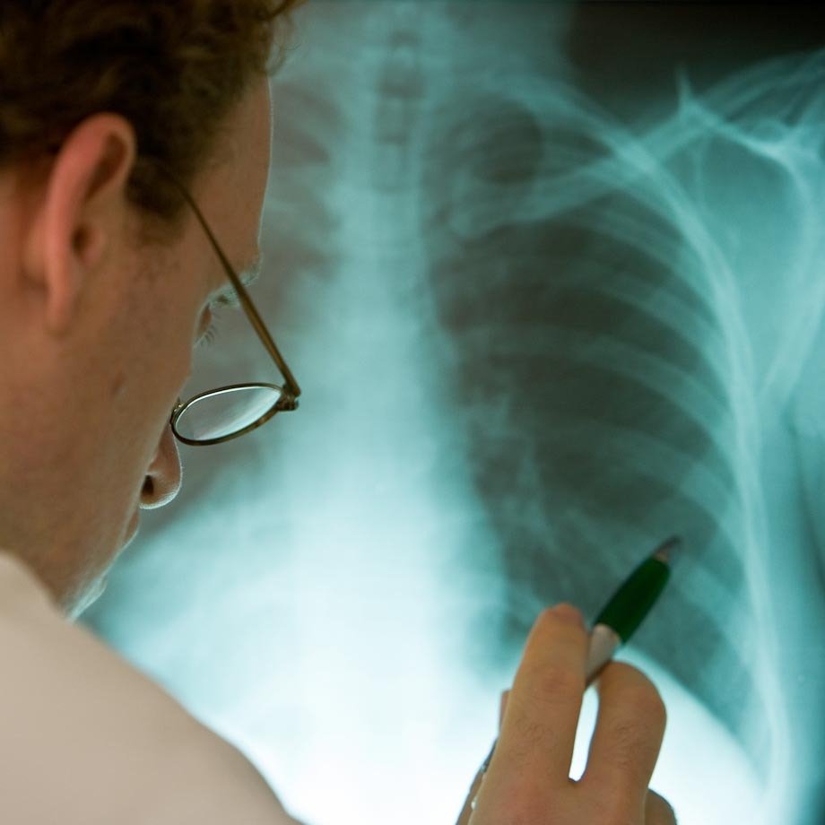 Doctor with an X-ray