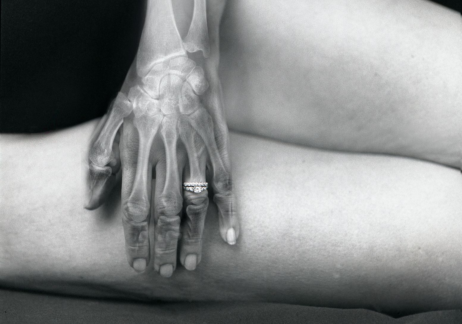 Suriani_092 hand xray.jpg