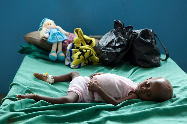A Malnourished child in the feeding centre. Fretown Hospital. Sierra Leone for VSO. 1sierra_leone_child_health_13.jpg