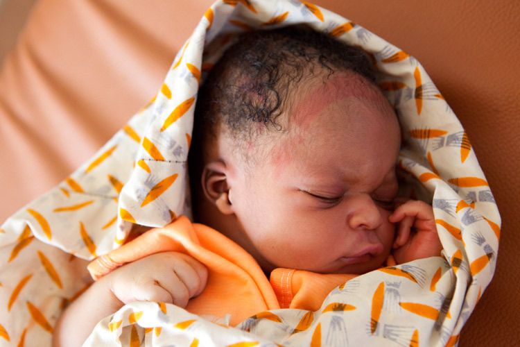 Newbornbaby is found to have a large lump on the back of its neck as well as limited reflexes on its right side. The child is probably brain damaged. The babys mother sits unaware on another bed in the labour room whilst she has a blood transfusion after birth difficulties. Makeni Government Hospital, Sierra Leone. 1sierra_leone_newborn_8.jpg