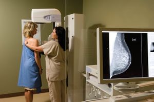 Digital Mammogram - Concord Imaging